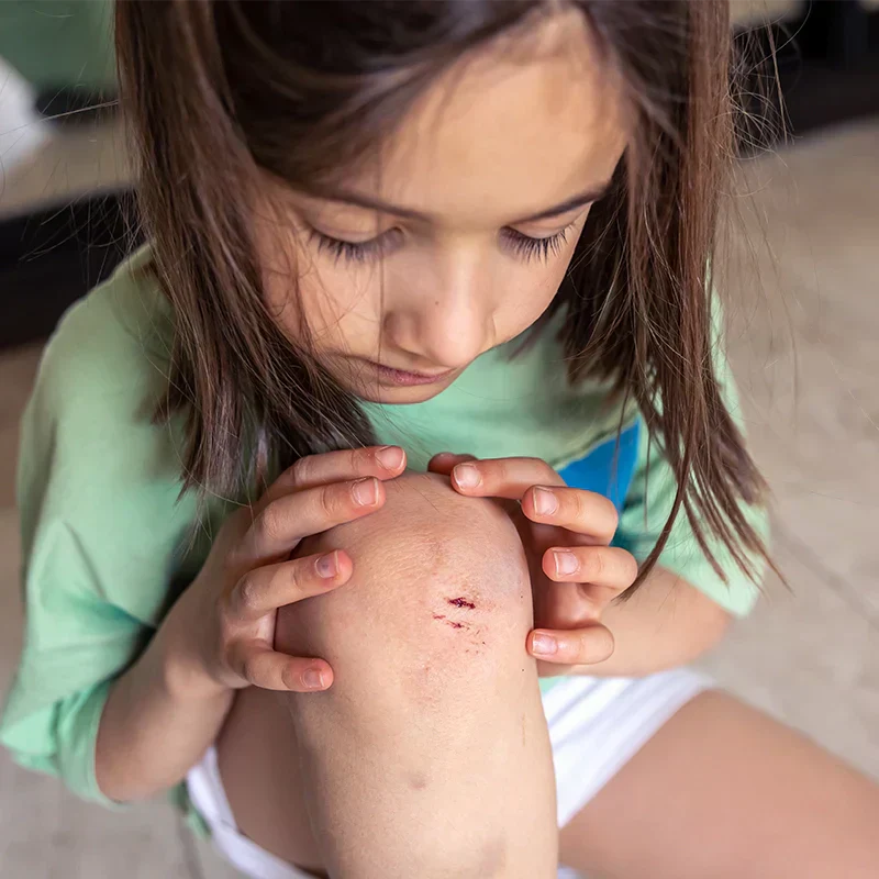 Astuce pour nettoyer la peau et l'aider à cicatriser les petites plaies