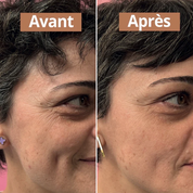 Sérum anti-âge