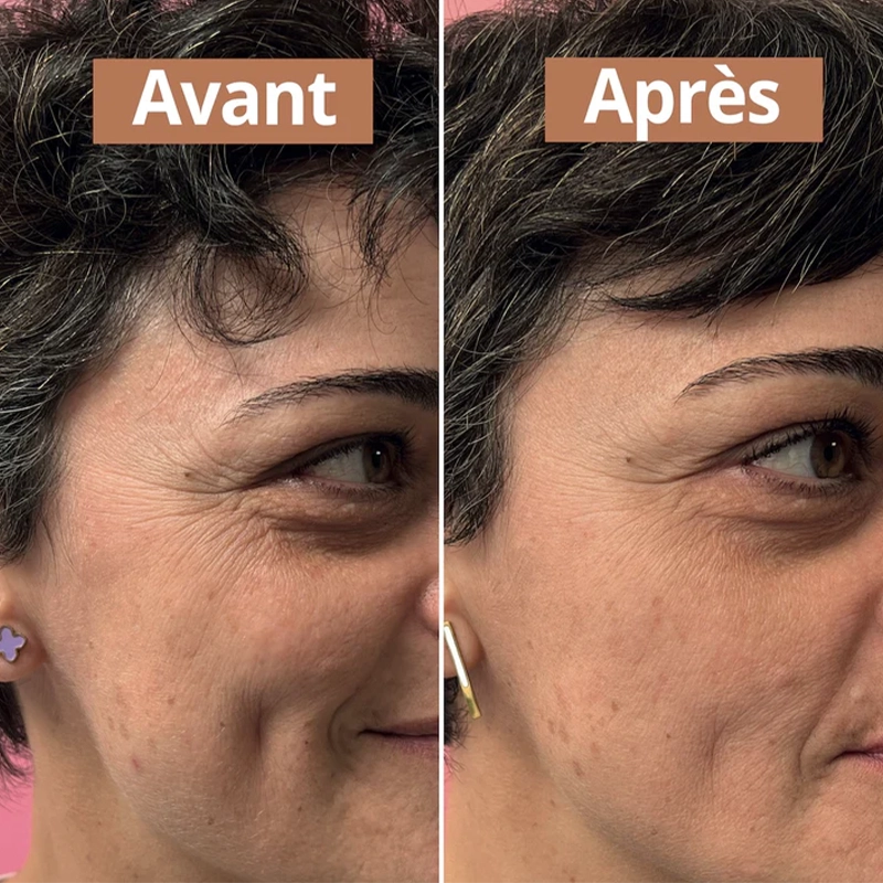 Sérum anti-âge